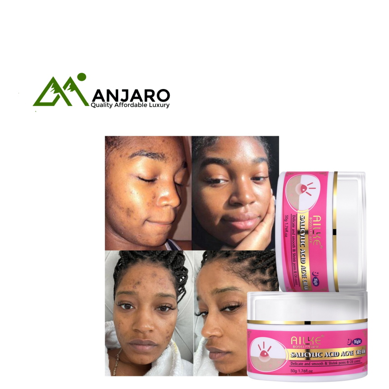 AILKE Diamond Anti-Acne Face Cream