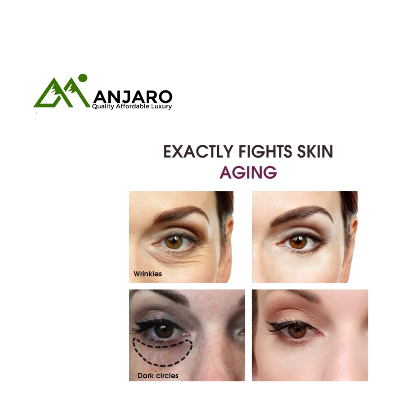 Ailke Eye Cream – Retinol Brightening Anti-Wrinkle Cream for Dark Circles & Puffiness